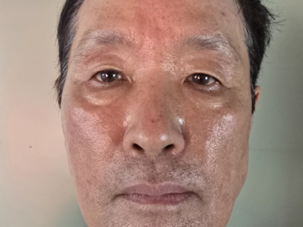 8회 체험후 촬영